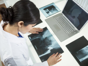 Dr. Reviewing X-Ray of Hips - Defective Medical Device Law - Martin, Harding & Mazzotti 1800law1010