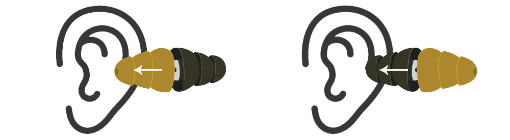 dual-ended-earplugs-illustration Dual Ended Earplugs Illustration - Defective Device Law - Martin, Harding & Mazzotti, LLP
