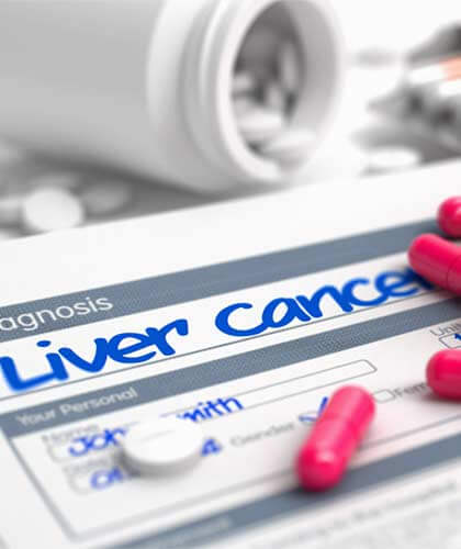 Liver Cancer Diagnosis - Pharmacy Recall Letter - Valsartan Lawsuit Recall