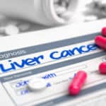 valsartan-cancer Liver Cancer Diagnosis - Valsartan Lawsuit Recall