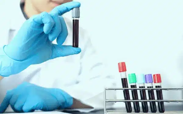 Tech holding vial of blood