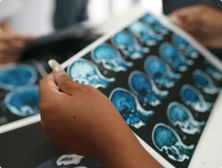 Closeup of brain scans